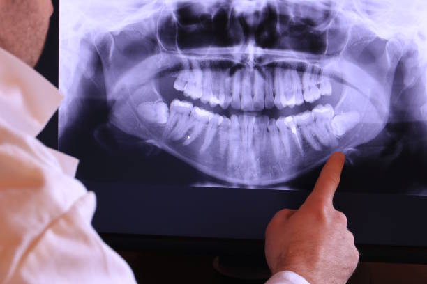 Best Emergency Dentist for Knocked-Out Tooth in Imlay City, MI