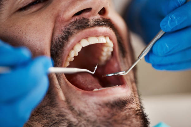 Best Emergency Cosmetic Dentistry in Imlay City, MI